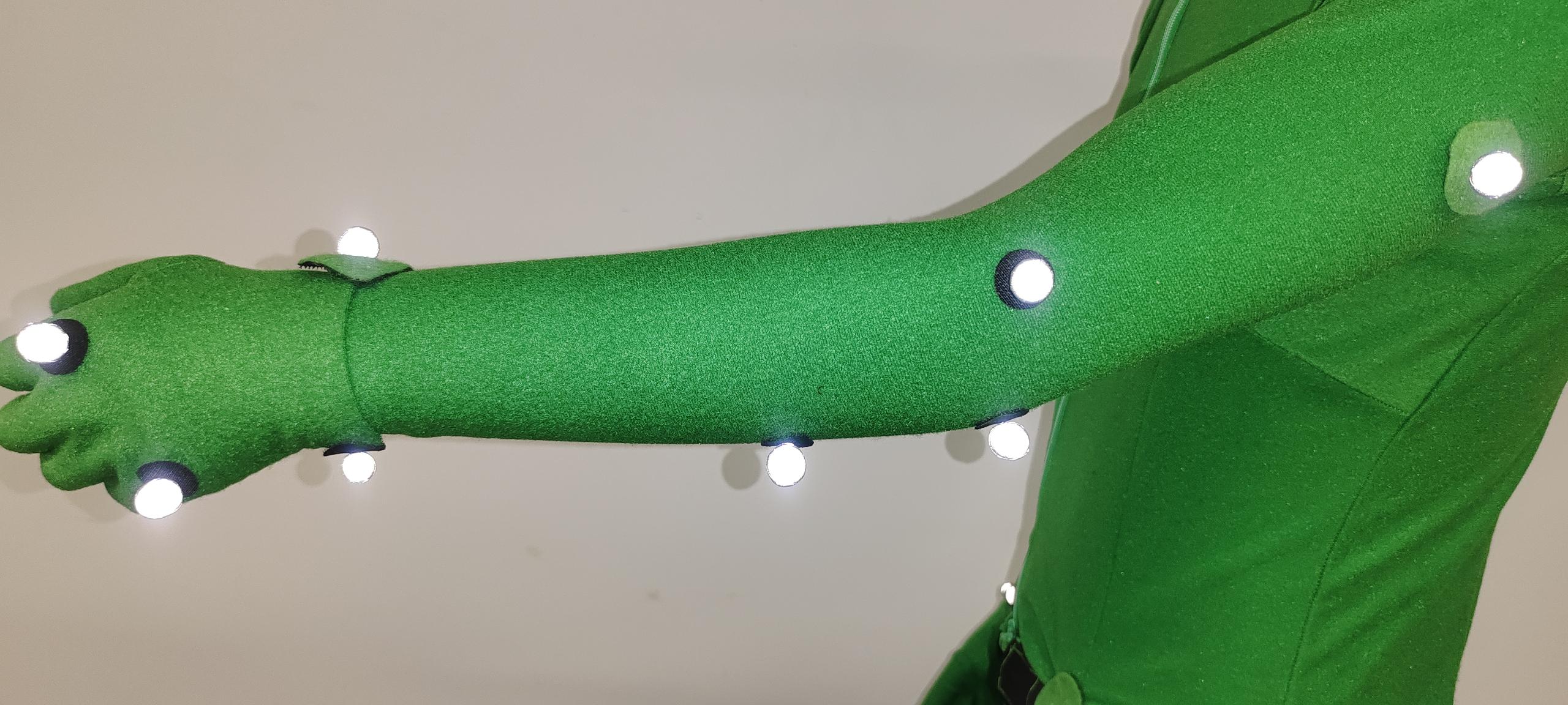 Left Arm View