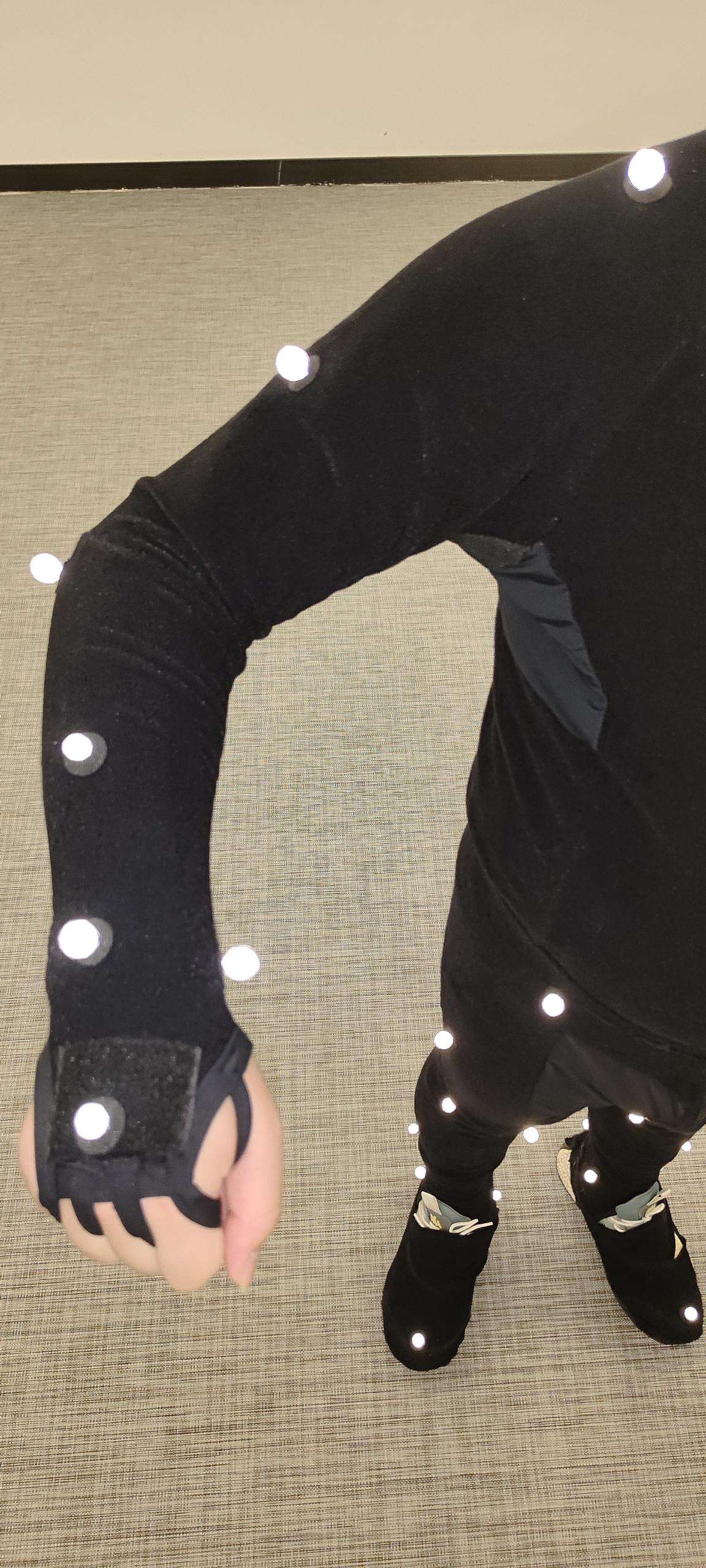 Right arm view