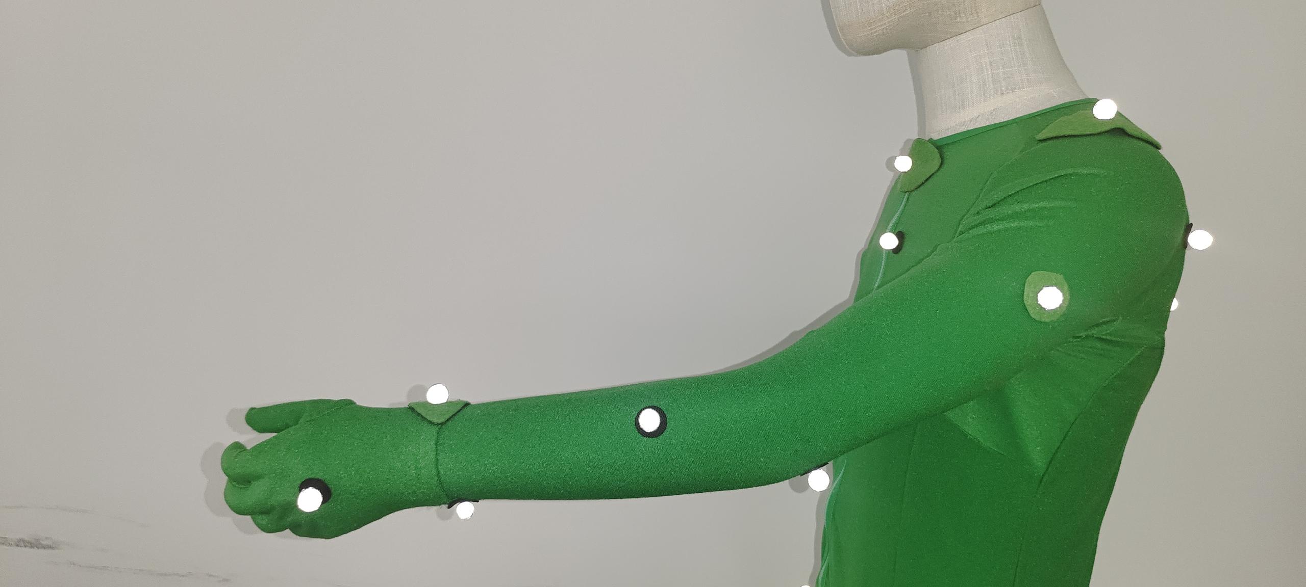 Right arm view