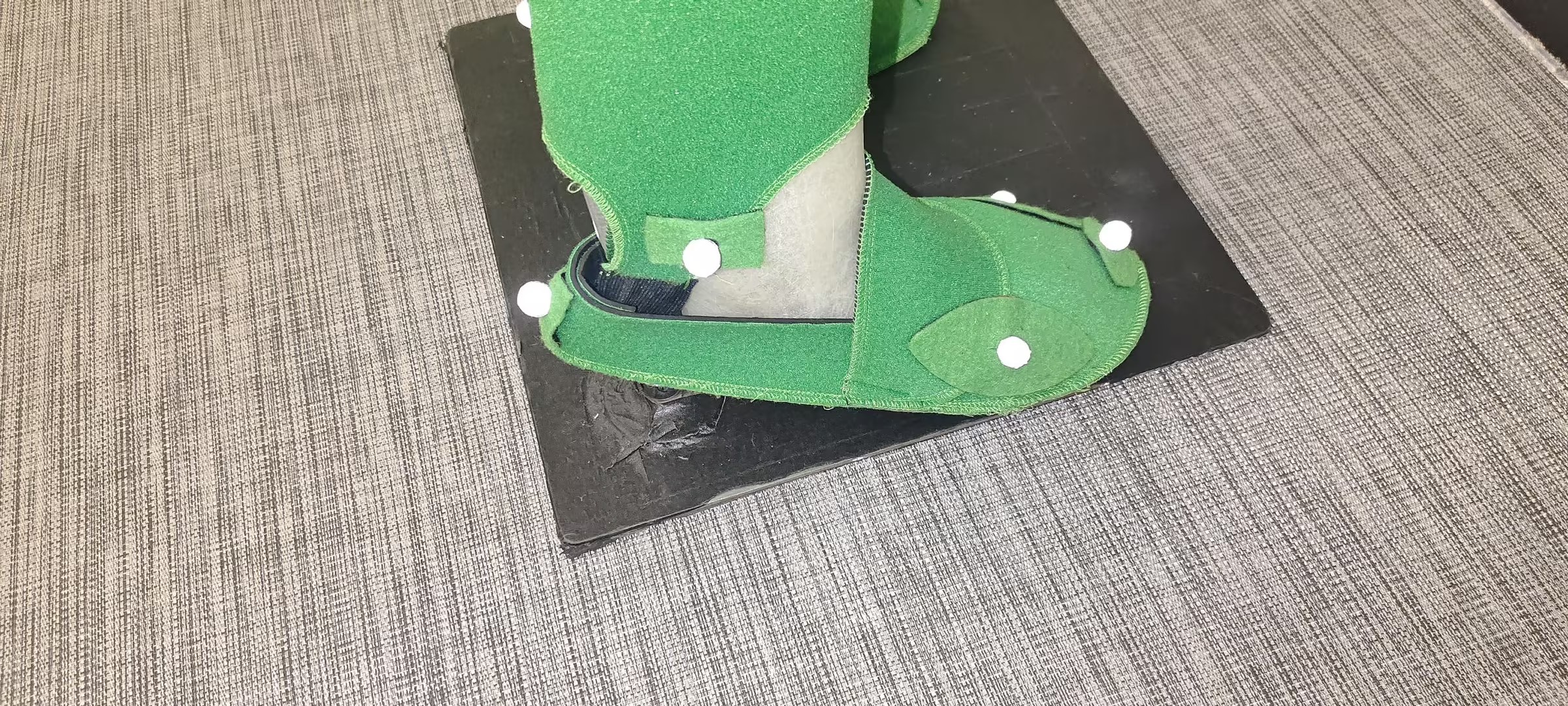 Right Sole of the Foot View