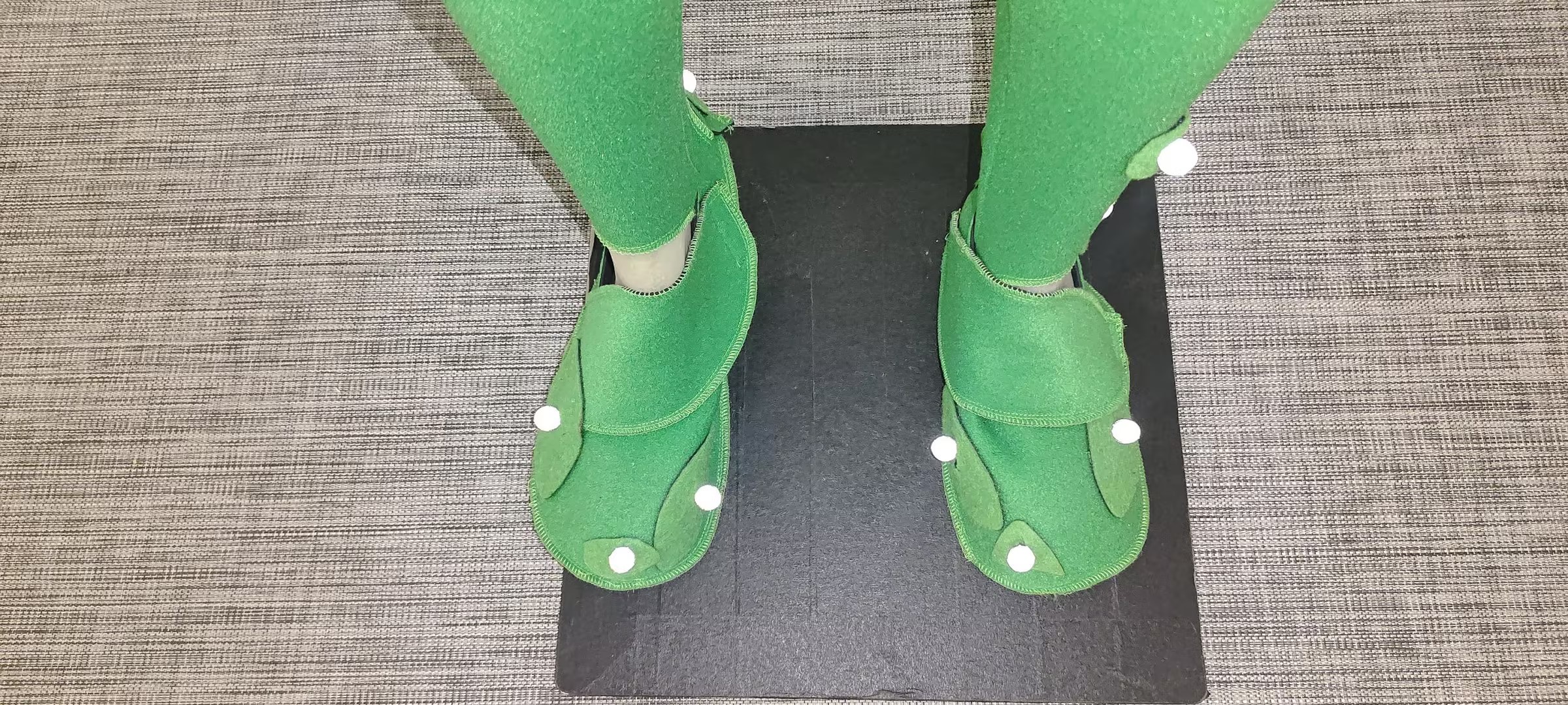 Front View of the Sole of the Foot