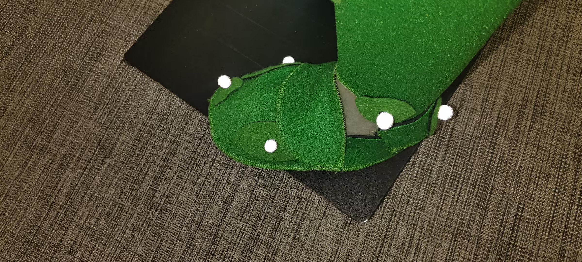 Left Sole of the Foot View