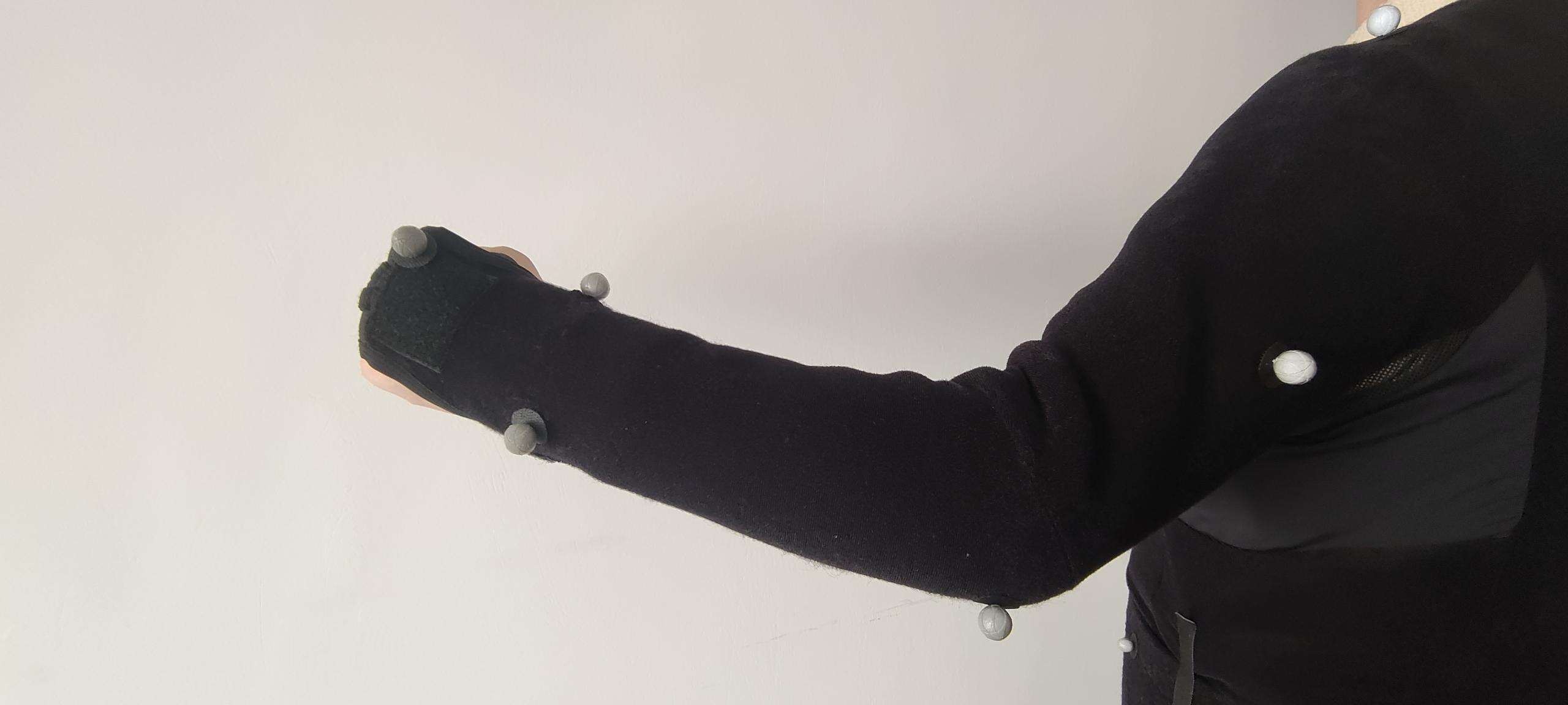 <em>Left Arm View</em>